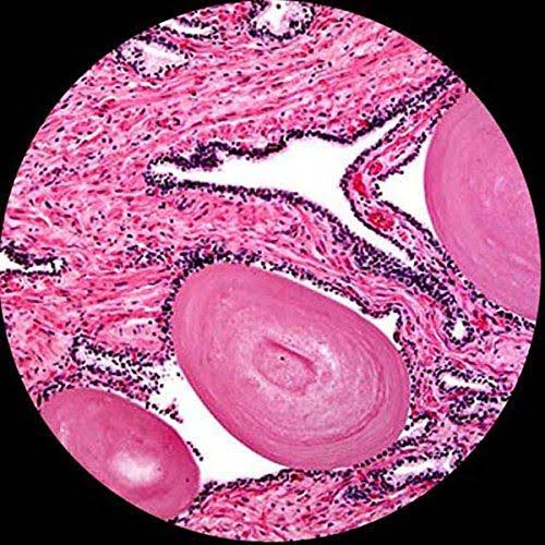 Binocular Microscope + 5MP Camera A532517